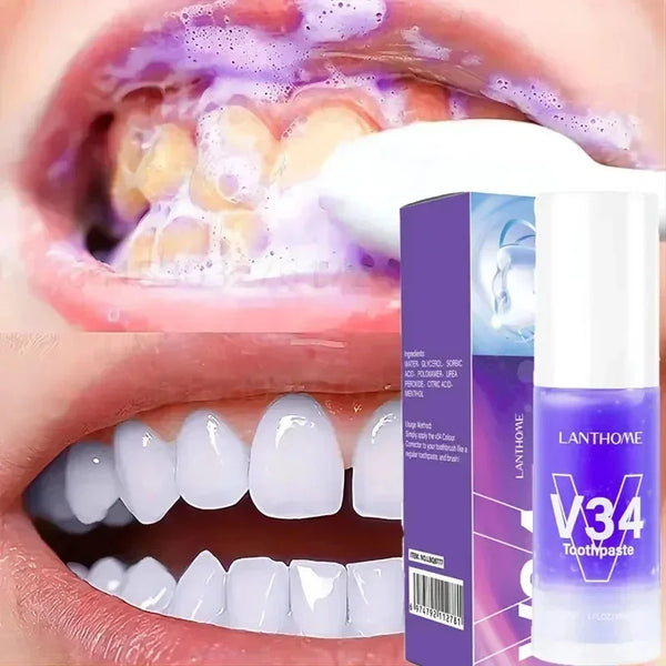 Clareador Dentário Smile Pro V34